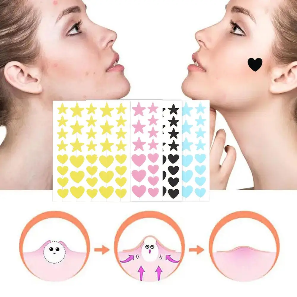 Invisible Acne Patch para reparar e cobrir, Acne Marcas, Coração em forma de solução para desvanecerse manchas, Ance tratamento capa