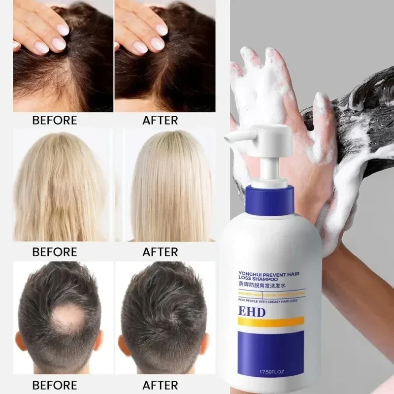 EHD Anti-Growth Hair Shampoo Nourishing Soft Fluffy Repair Roots Men Women Promotes Dense Growth Strengthens Hair