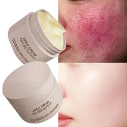 Creme Reparador de Vermelhidão Facial, Hidratante, Loção Calmante, Remoção, Acne, Sensível, Hidratante, Cosméticos Coreanos