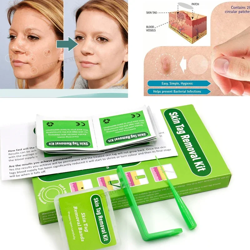 

Skin Tag Removal Kit Papilloma Removal Skin Cleansing Band Kit For Remove Skin Berrugas Wart Dots Mole Removal Beauty Appliances