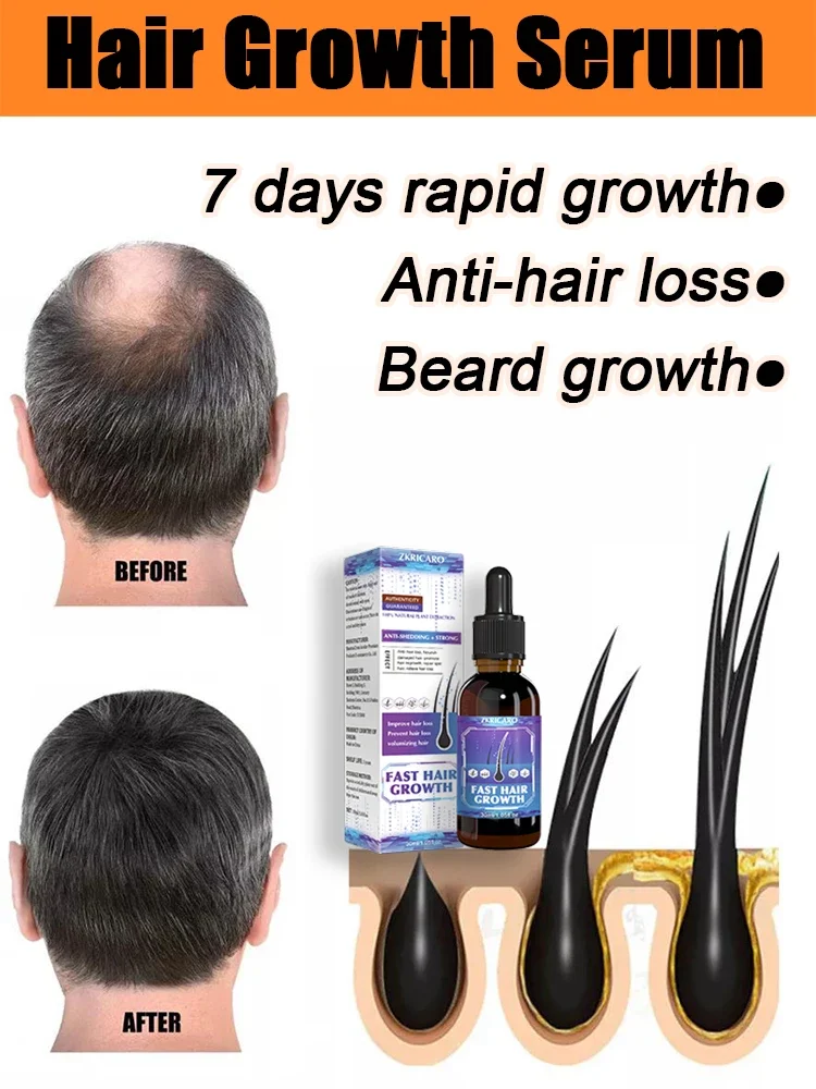 

Hot sale, buyers will buy again, hair is getting more and more, say goodbye to baldness, sparse hair starts to become thick