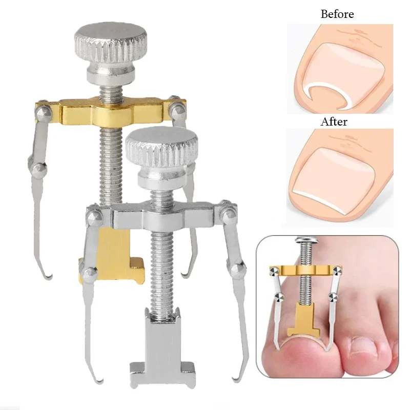 Ingrown Toenail Corrector Straightening Clip Pedicure Foot Nail Care Tools Stainless Steel Pedicure Treatment Onyxis Correction