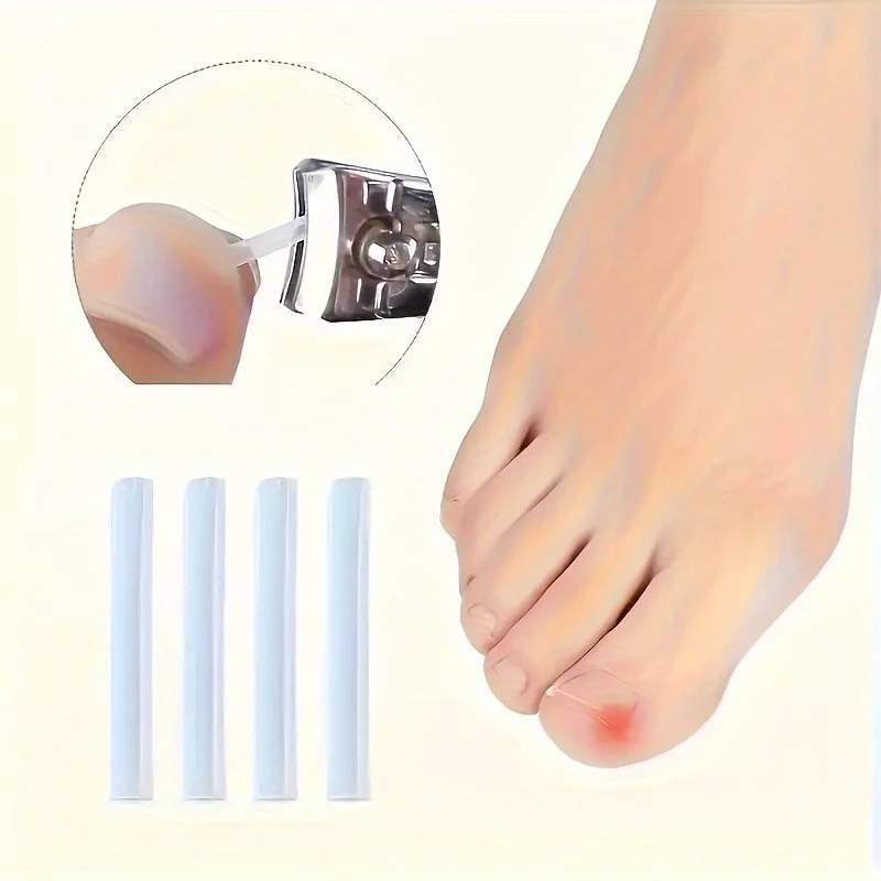 Ingrown Toenail Correction Kit 10/20/30/50 Pack Professional Foot Care Tools Nail Care Pedicure Set Portable Pedicure Kit for...