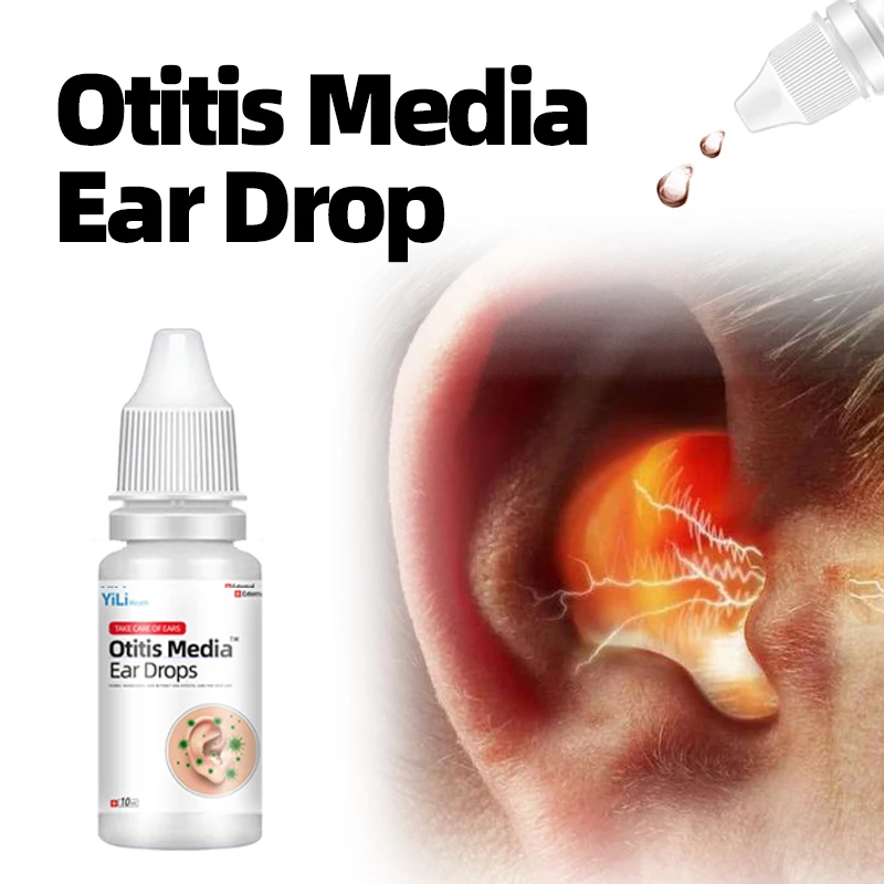 

Otitis Media Ear Drop 10Ml Medicine For Ear Pain Bacterial Infection Itching Acute Otitis Cure Ear Wax Remover Cleaner Drops