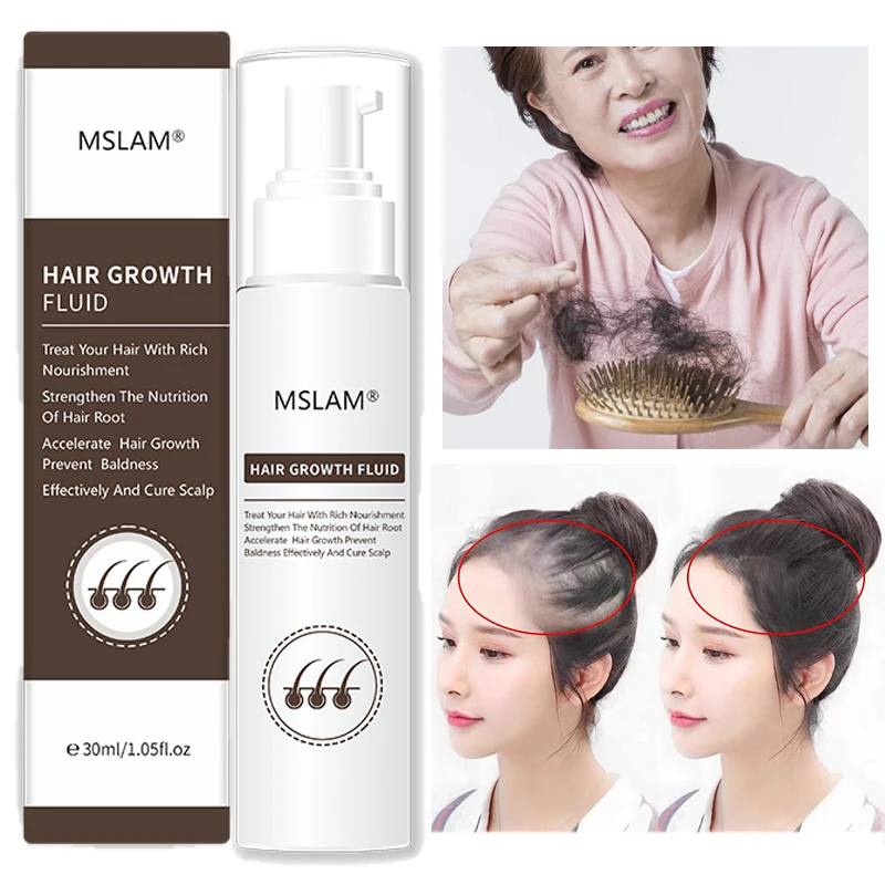 

Hair Growth Product Care Scalp Spray Anti Hair Loss Treatments Anti Hair Loss Oil Effective Grow Thicker/Longer Hair Essence