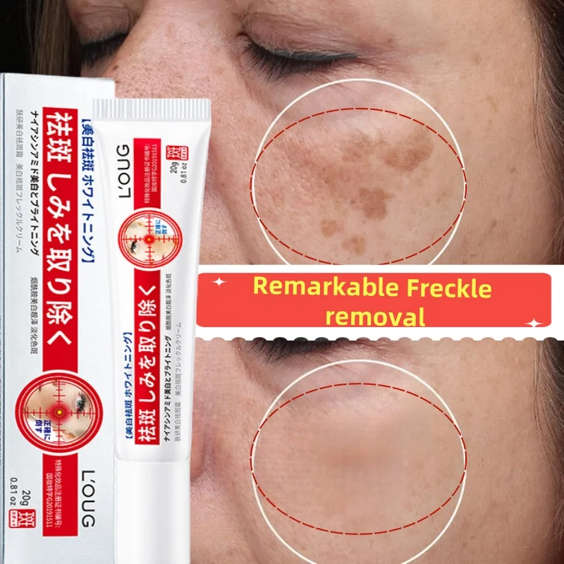 

Powerful Spot-Removing Whiten Cream Brighten Skin Fast Eliminates Melanin Pigmentation Melasma Dark Spots Korean Skin Care 20g