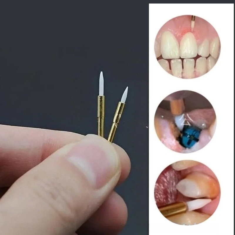 Dental Ceramic High Speed Bur for Soft Tissue Trimming, Bloodless Gingiva Cutting Retraction No Cooling Required