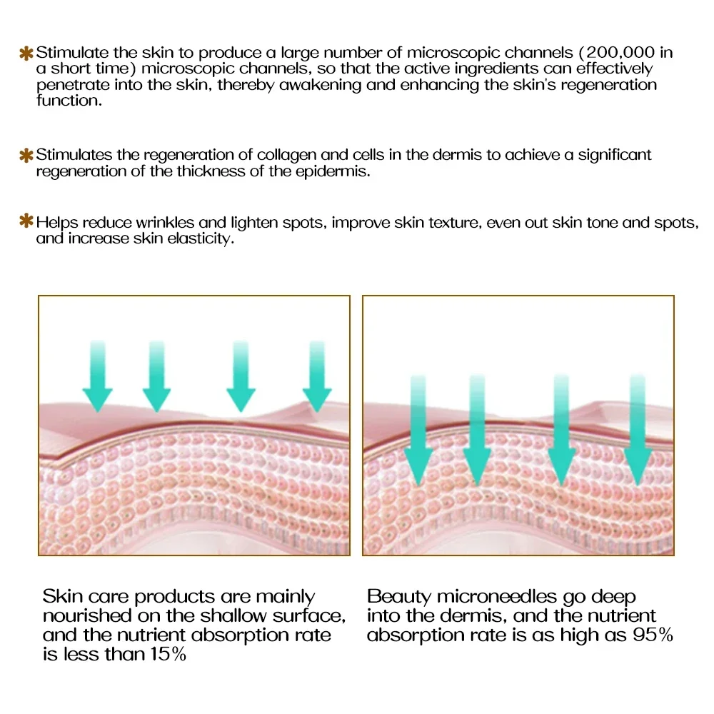 1P 0,2/0,25/0,3mm ZGTS 192 Titan-Mikronadeln Derma-Roller Hautmassage für Haarwuchs, Falten- und Narbenentfernung, Hautstraffung – Detail 11