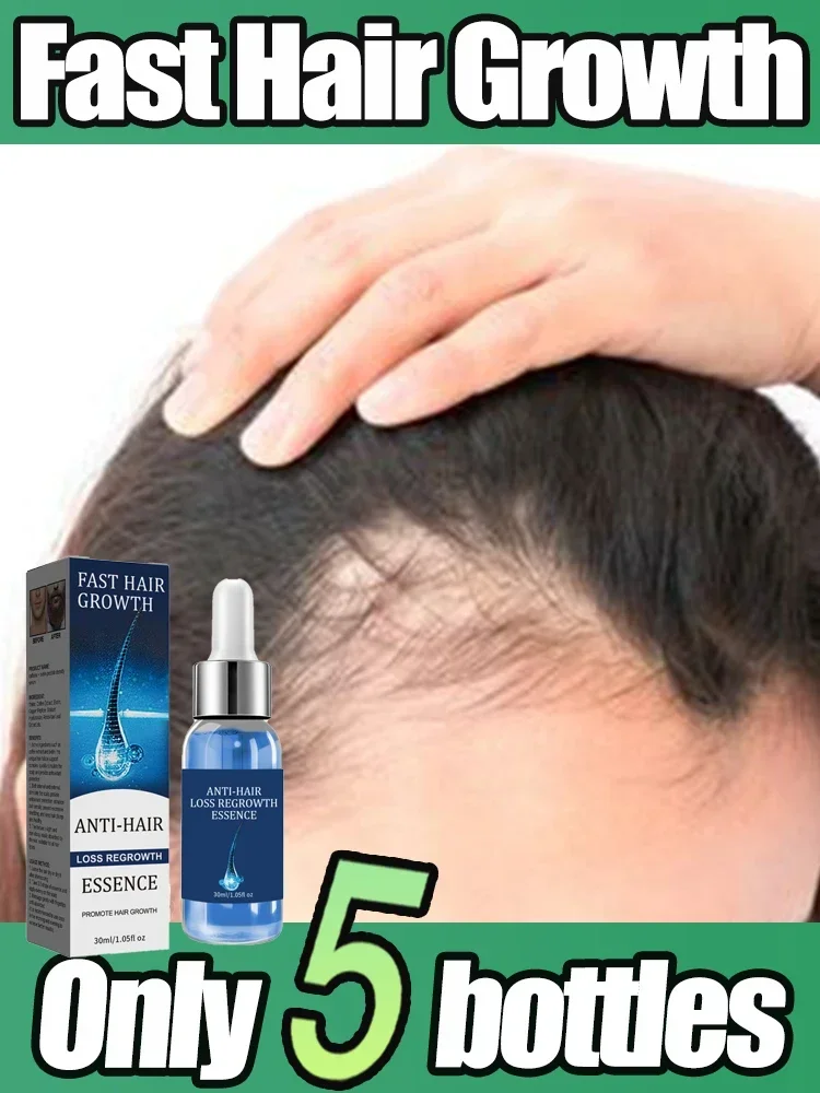 Fast Hair Growth Oil Effective Baldness Repair Hereditary Hair Loss Postpartum Seborrheic Hair Anti Loss