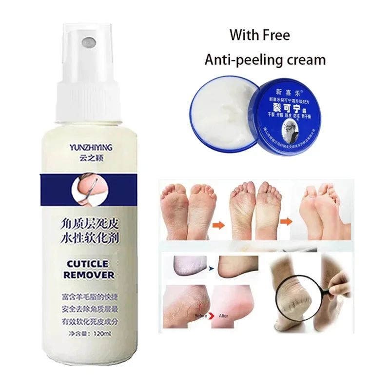 Exfoliante de pies, suavizante en aerosol, 6 segundos, elimina callos de piel muerta, mascarilla para pies, potenciador del talón antigrietas, Kit de pedicura de uñas, 120ml