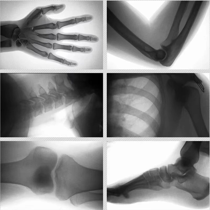 Lightweight portable medical X-ray machine with 10-inch LCD screen that can display images in real time, suitable for use in amb