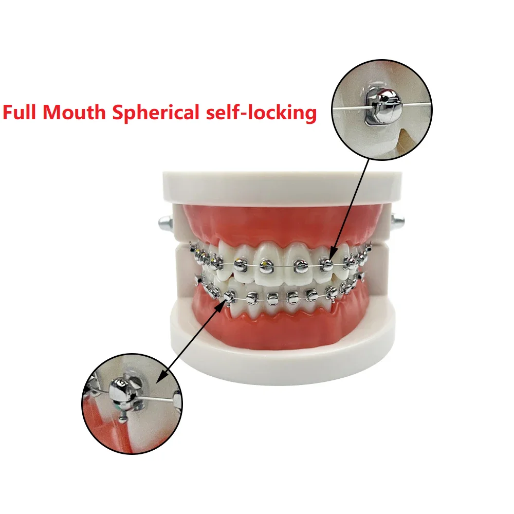Dental Teaching Modell Standard Dental Kieferorthopädische Zähne Modell Mit Zahnspangen Metall/Keramik Klammern Für Zahnmedizin Bildung Studie
