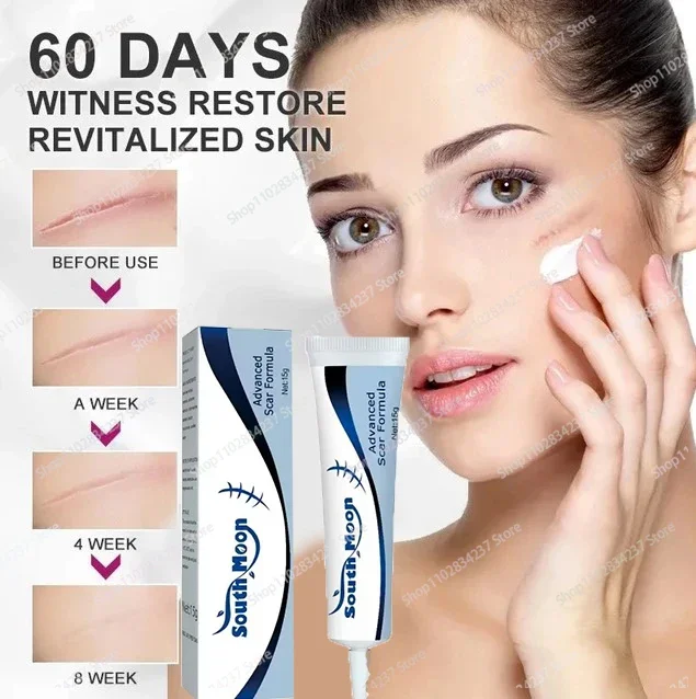 Scar Repair Acne Scar  Remover For Burn Scars Postoperative Scar Removal Skin Smoothing