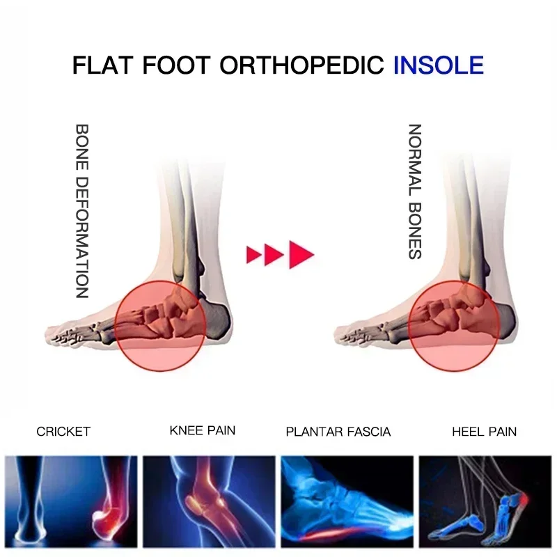 Professional  Arch Support Insole Flat Foot Corrector Shoe Cushion  orthopedic pad  bicycle football running sports insoles