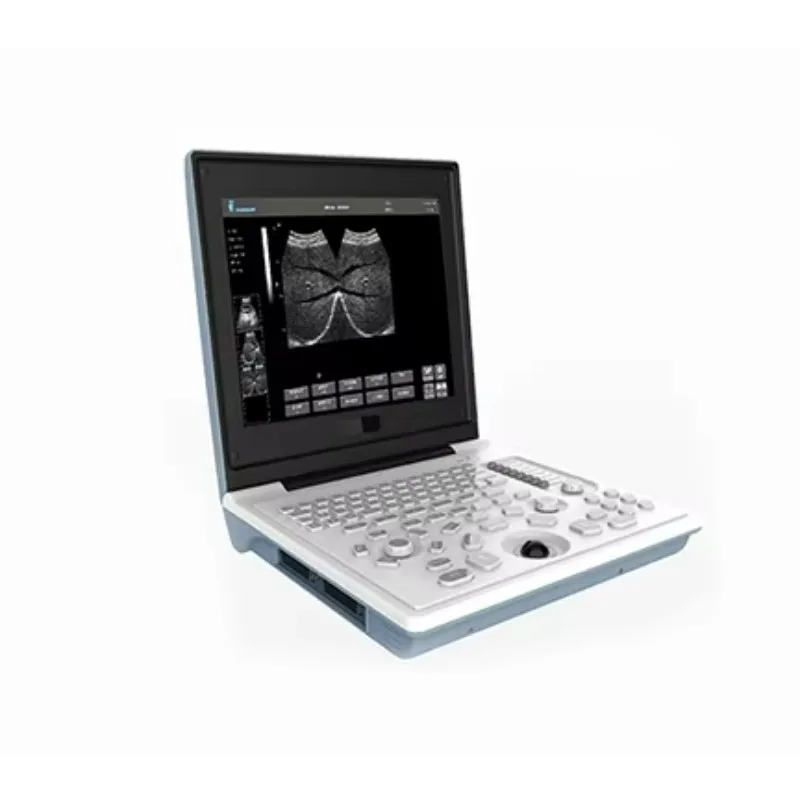 Laptop Type  Black White Ultrasound Scanner with Good Price