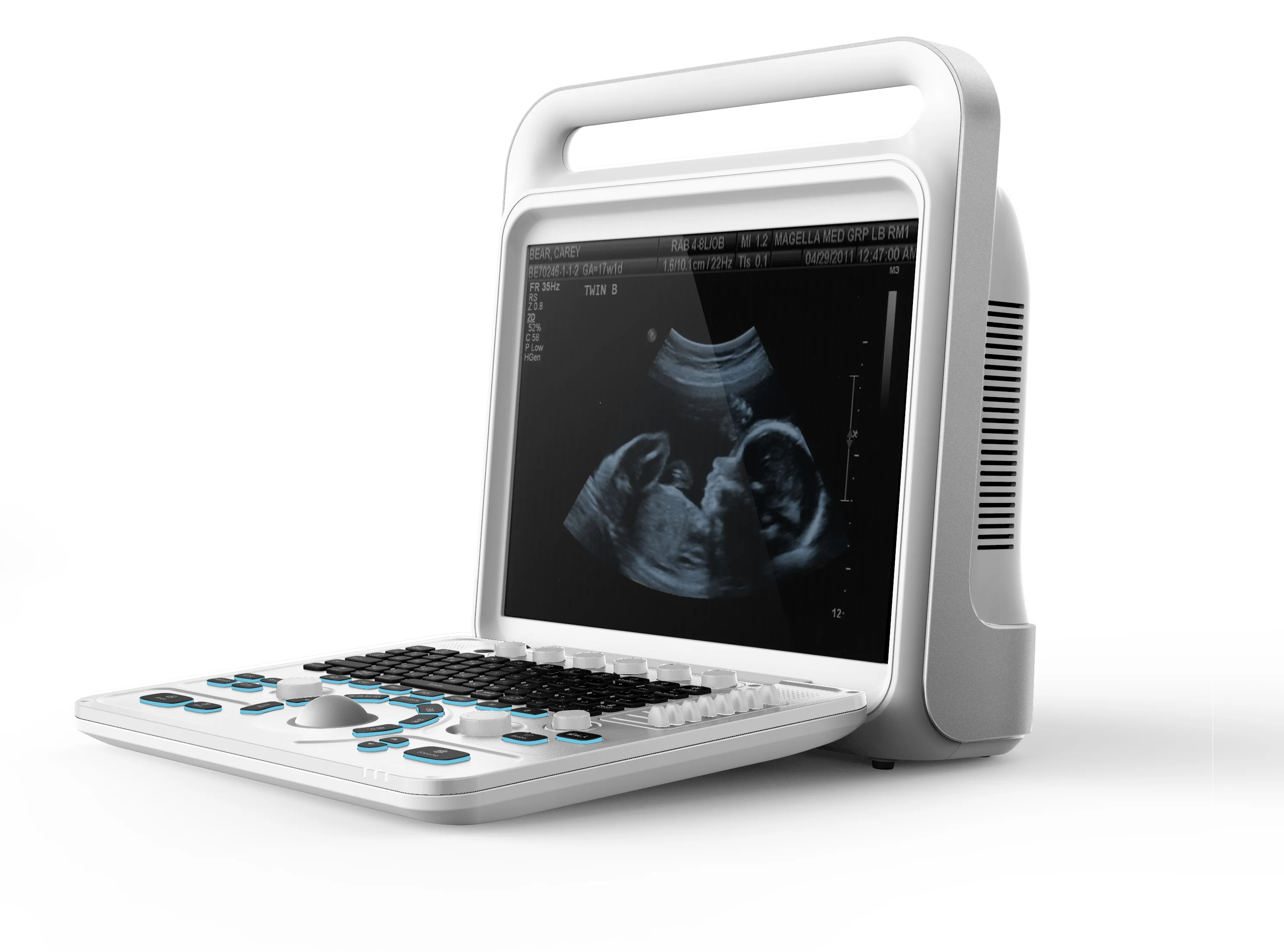 Ultra sound machine portable ultrasonic scan knee injury sonography machine prices gray scale supply hospital equipments