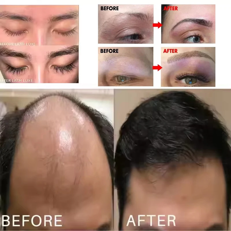 Szybkie Serum na Porost Brwi Rzęs Włosów Przeciw Wypadaniu Włosów Zapobiega Łysieniu Większe Grubsze Wydłużające Makijaż Brwi