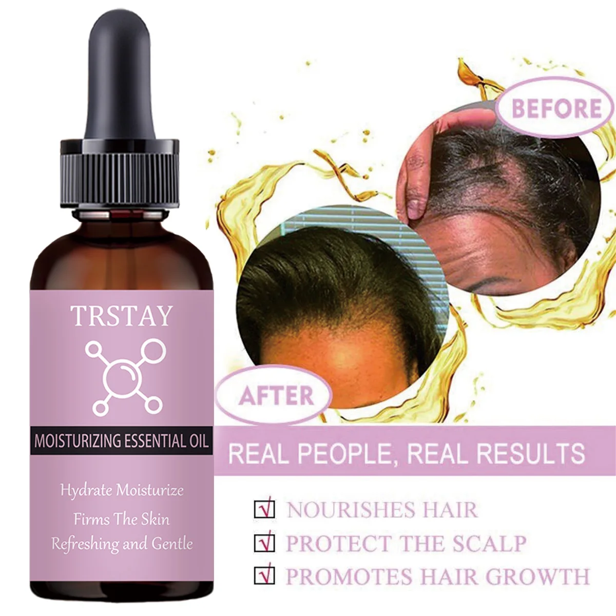 

Soften Scalp Repair Damaged Hair Growth Essential Oils Essence Care Products Hair Loss Restore Dense Hair Thicker Liquid Serum
