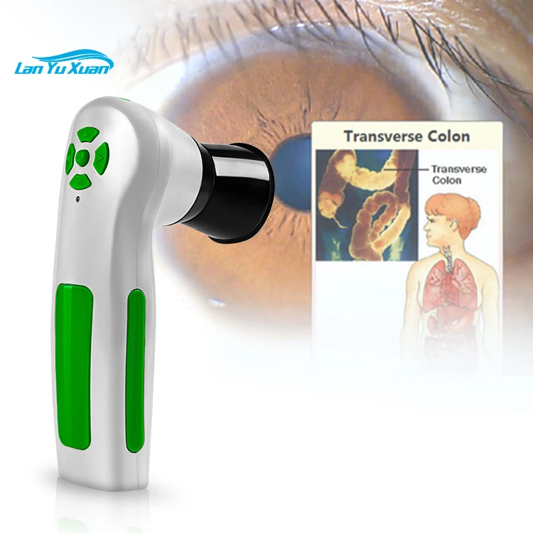 Portable Iriscope Iris Analyzer Auto Iridology Camera Eye Iriscope Analyzer Software