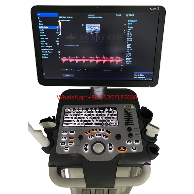 

Mindray DC-26 3D 4D Ultrasound Color Doppler Trolley Ultrasound Machine Scanner DC-26 Mindray