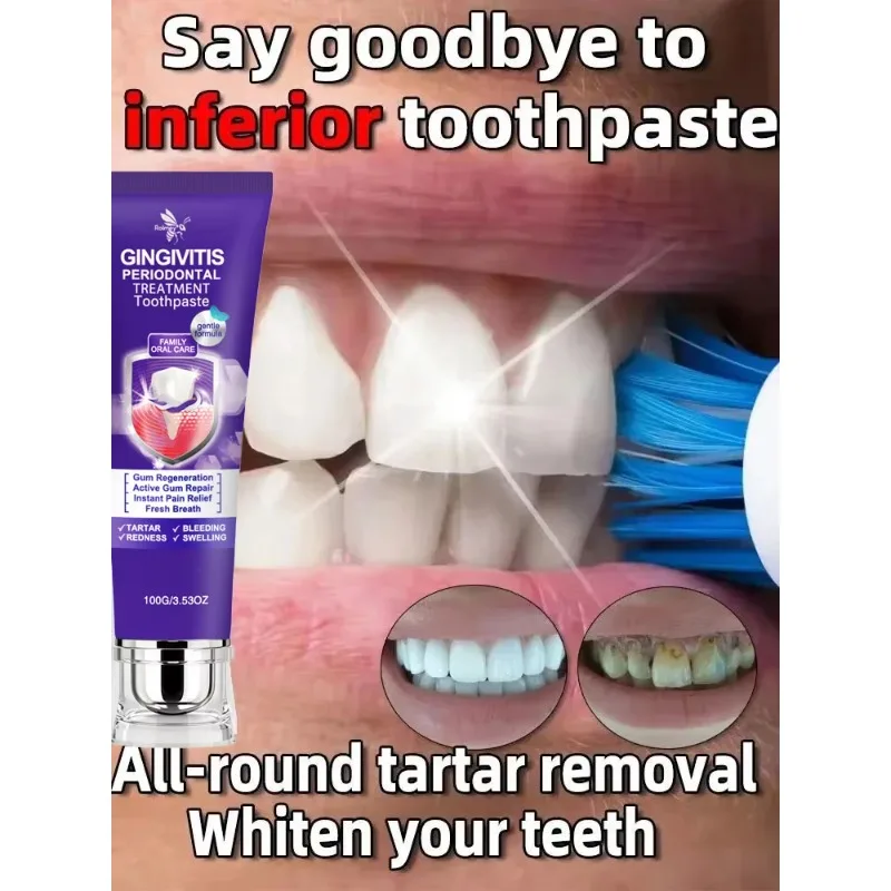 Toothpaste that removes tartar, whitens teeth, eliminates bad breath, improves halitosis, and prevents periodontitis
