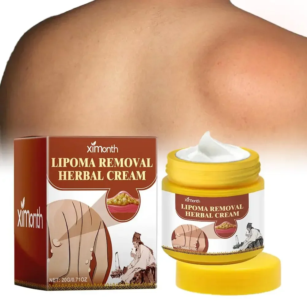 20g Lipoma Cream Subcutaneous Lumps Remover Treatments Skin Swelling Cellulite Fibroma Fat Mass Plaster