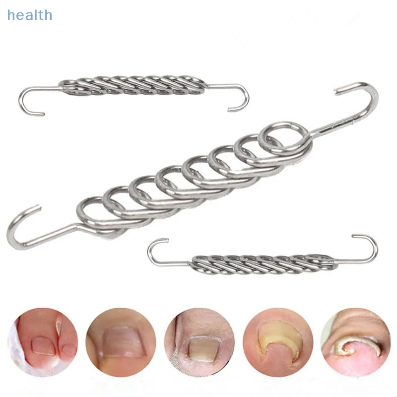 Strumenti per la correzione dell'unghia del piede incarnita Pedicure Recupera nel trattamento delle unghie dei piedi incorporati Strumento professionale per la cura del piede per la correzione dell'unghia del piede incarnita