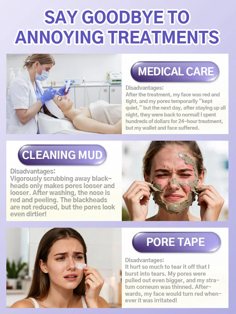 منتجات العناية بالوجه الأكثر مبيعًا في عام 2025 للمسام الكبيرة، للجنسين