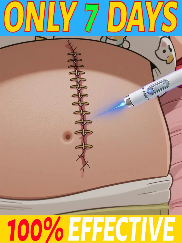 

Модернизированный инструмент синего света 3-го поколения, ремонт корней шрамов, быстро