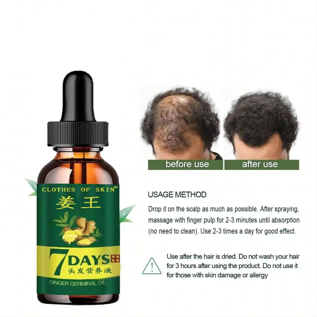 7 Day Ginger Germinal Hair Growth Serum Hairdressing Oil Loss Treatment Strengthen Hair Root