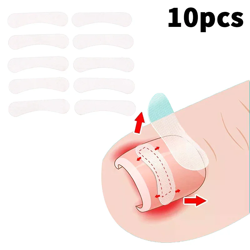 Outil de Correction des ongles incarnés, Clip de redressage, attelle de traitement des ongles incarnés, Patch élastique autocollant, outil de pédicure, 10 pièces
