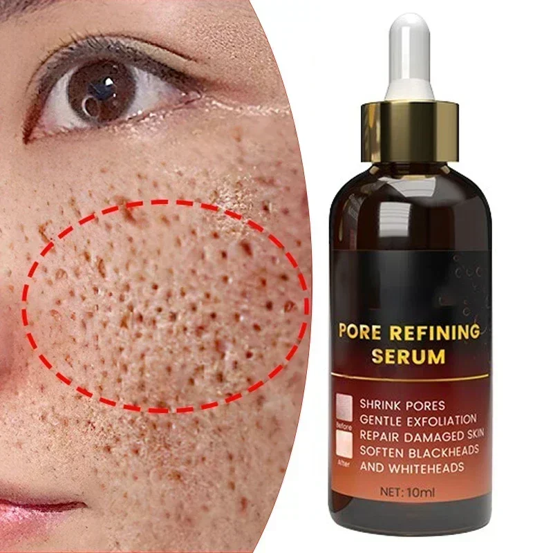 Suero Facial retráctil de poros, elimina puntos negros, acné, Control de aceite, esencia reparadora, hidratante, nutre los poros, reafirmante, cuidado Facial