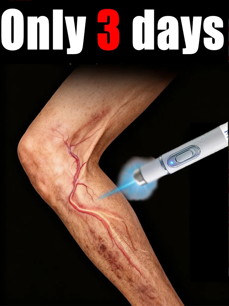 

95% клиентов выбирают варикозное расширение вен.