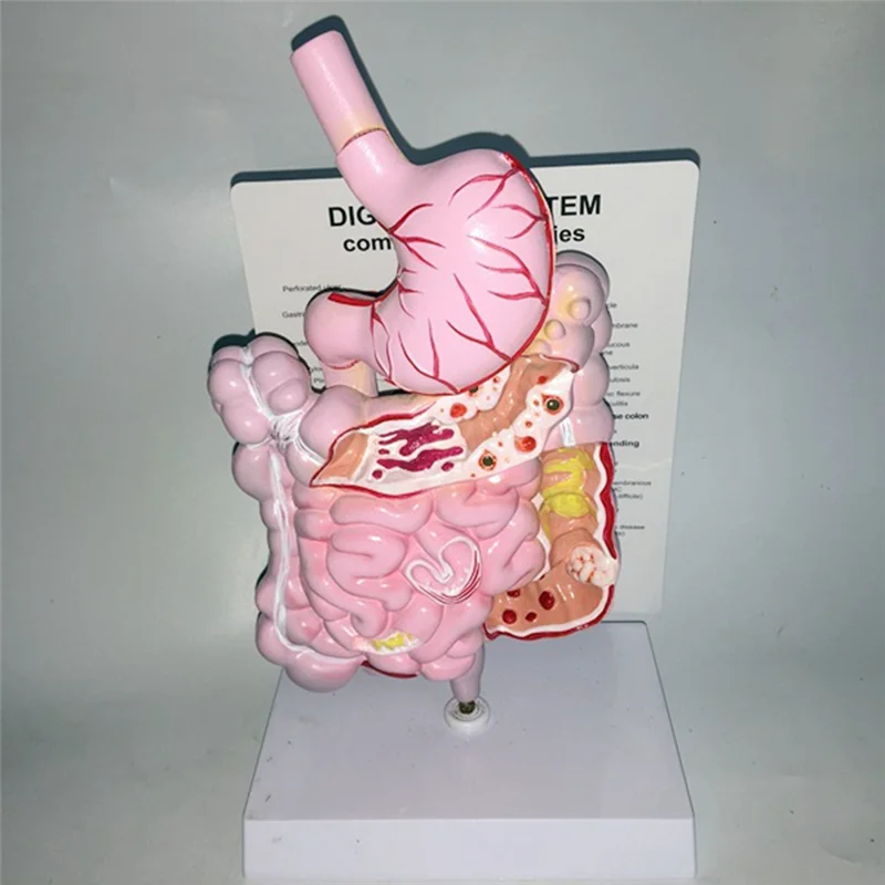 十二指腸盲腸直腸胃腸人間の消化器系の解剖学内臓構造モデル