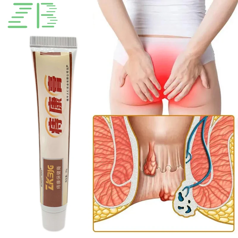 1Pcs  Hemorrhoids Ointment Internal And External Piles Therapy Anus Pain Swelling Bleeding Relieve Anal Fissure Herbal Cream