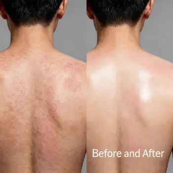 Kyselina mandlová 40% Peeling na obličej 18% 30% 10% - Chemická exfoliace Profesionální kosmetická kvalita 30ml Jemný exfoliační roztok s AHA 10 nejlepší prodej chemický peeling - №3