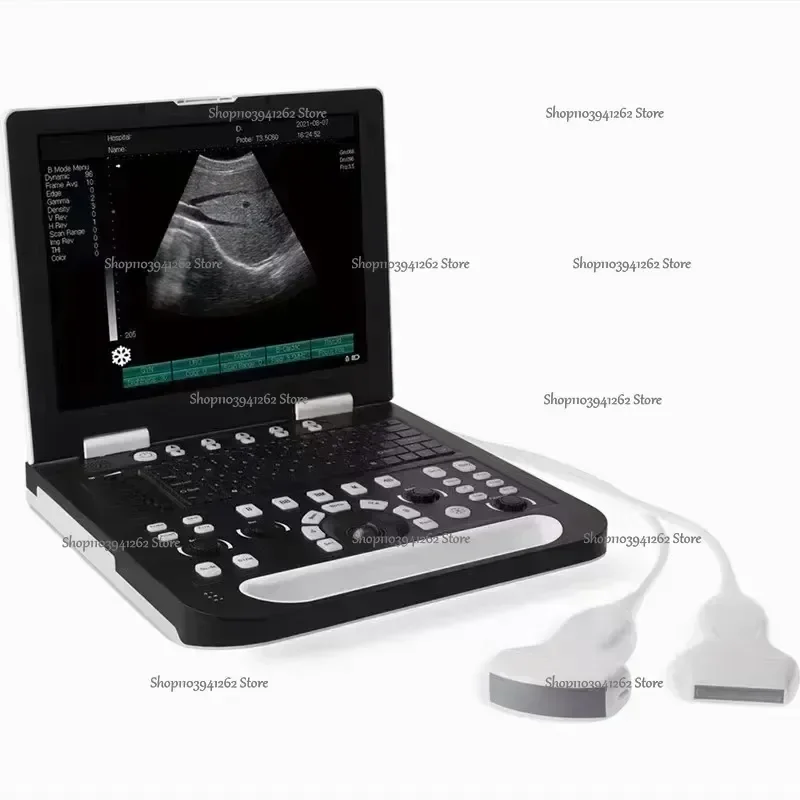 Portable KR-2288Z Full Digital Ultrasonic Machine Made in China Medical Home Use Electric Notebook Scanning Metal Construction