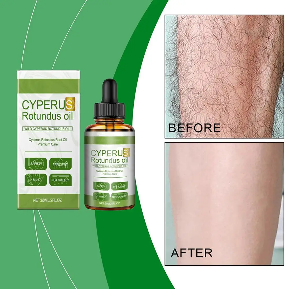 

60ml 100% Natural Cyprus Oil Reduce Prevent Hair From Inward Growing I0O0