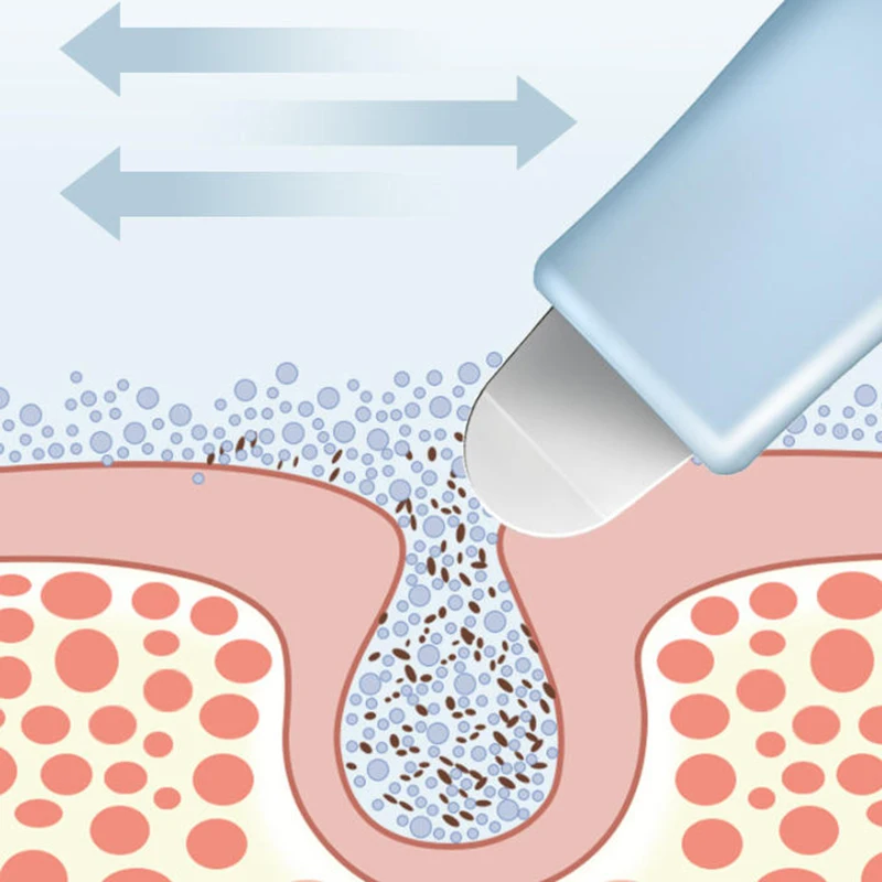 أداة إزالة الرؤوس السوداء والرؤوس البيضاء للتنظيف العميق للأنف والوجه، منظف المسام، مكشطة الوجه، أدوات التجميل للعناية بالبشرة
