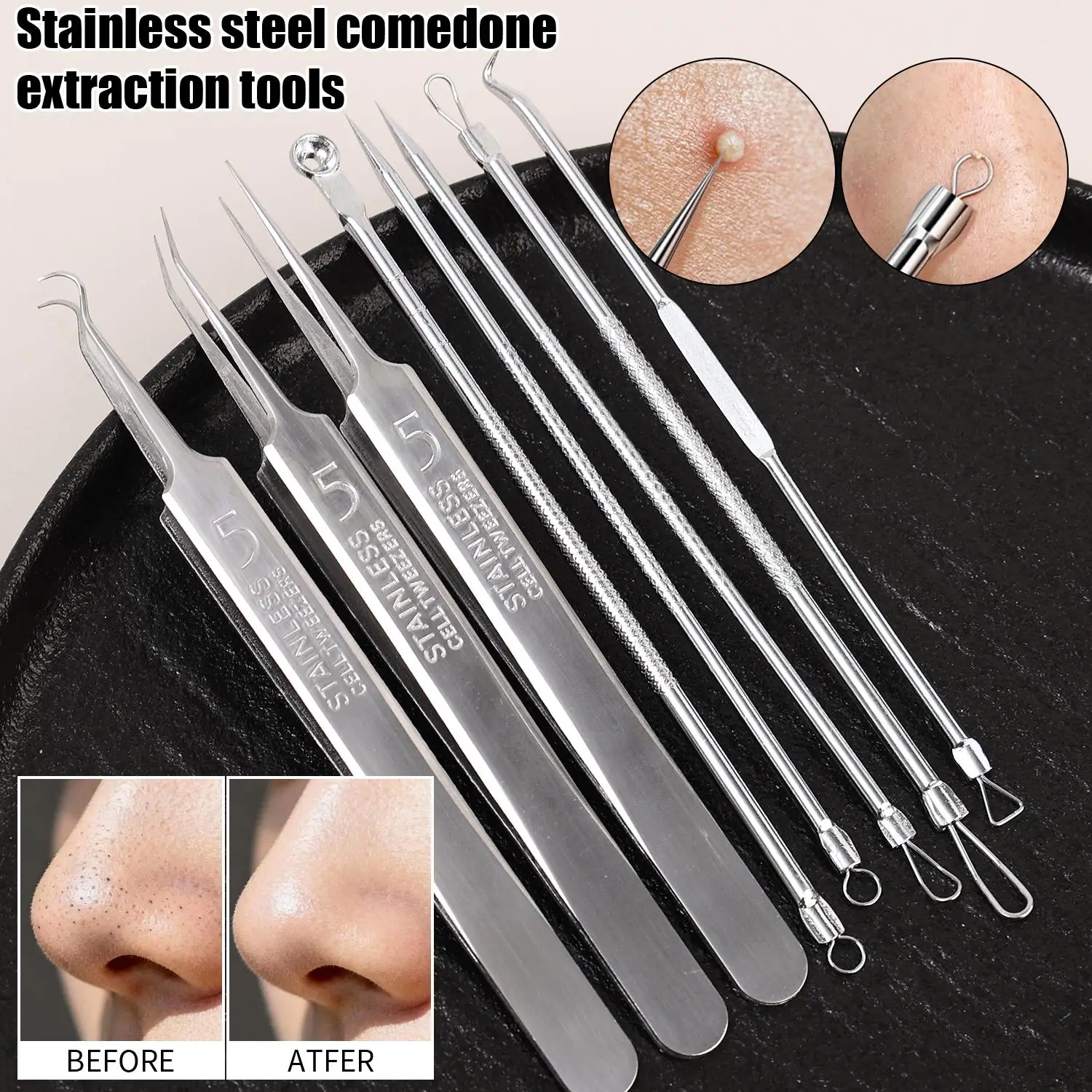 kit-removedor-de-cravos-de-3-5-8-pecas-em-aco-inoxidavel-ferramentas-de-extracao-de-acne-e-espinhas-ferramentas-de-limpeza-para-todos-os-tipos-de-pele