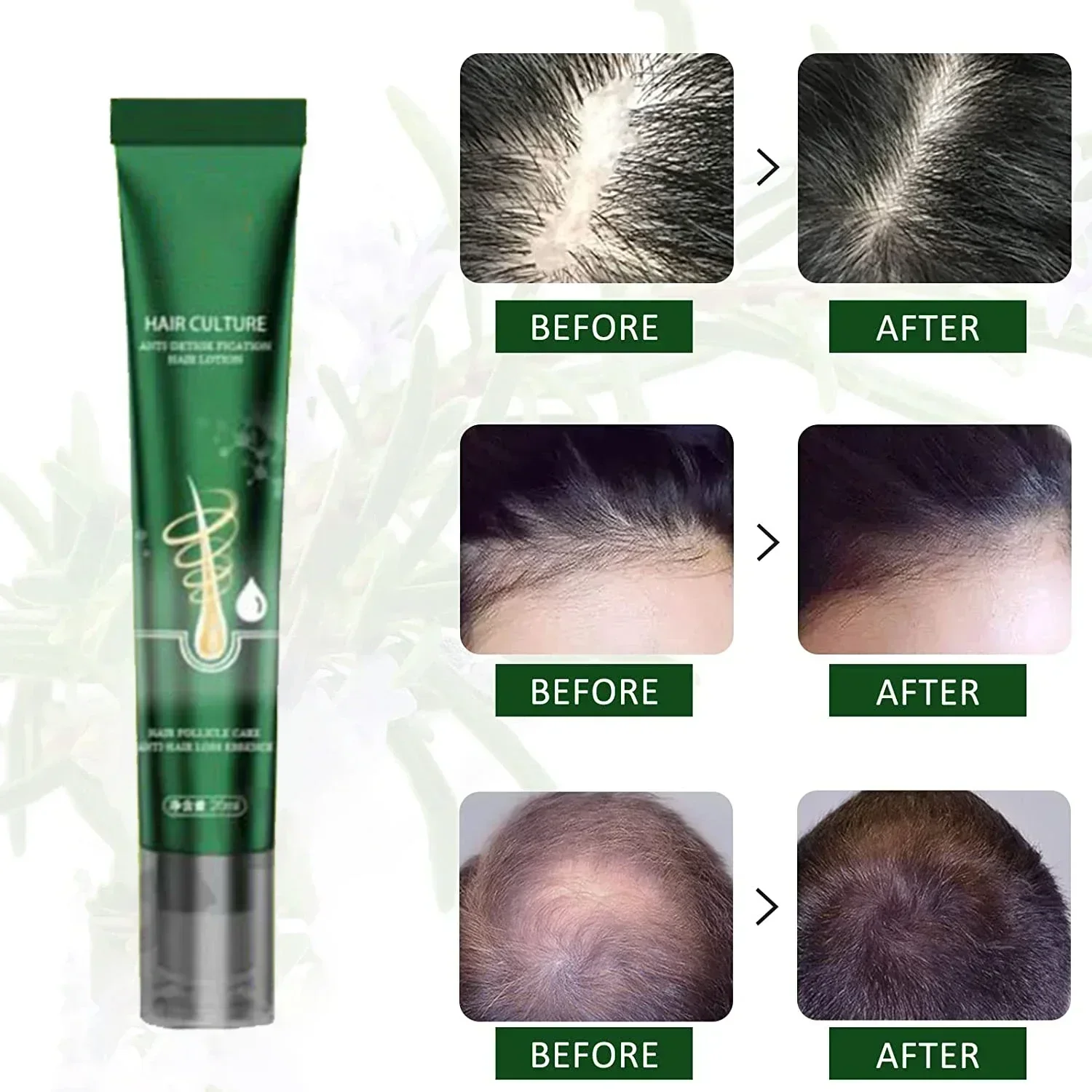 Hot sales Hair Growth Essential Loss Regrowth Treatment Strengthens Hair Nourishes Scalp Light Weight Non Greasy Improve Scalp C