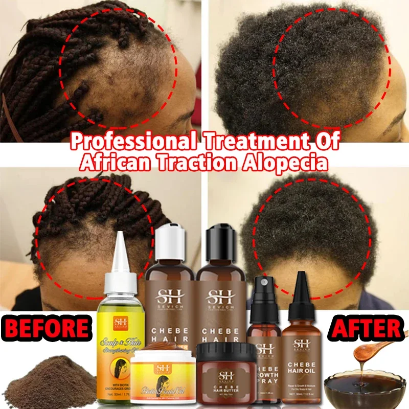 Chebe Powder Shampoo Anti-Hair Loss Spray Get Rid of Wigs Africa Women Traction Alopecia Treatment Hair Growth Product for Men