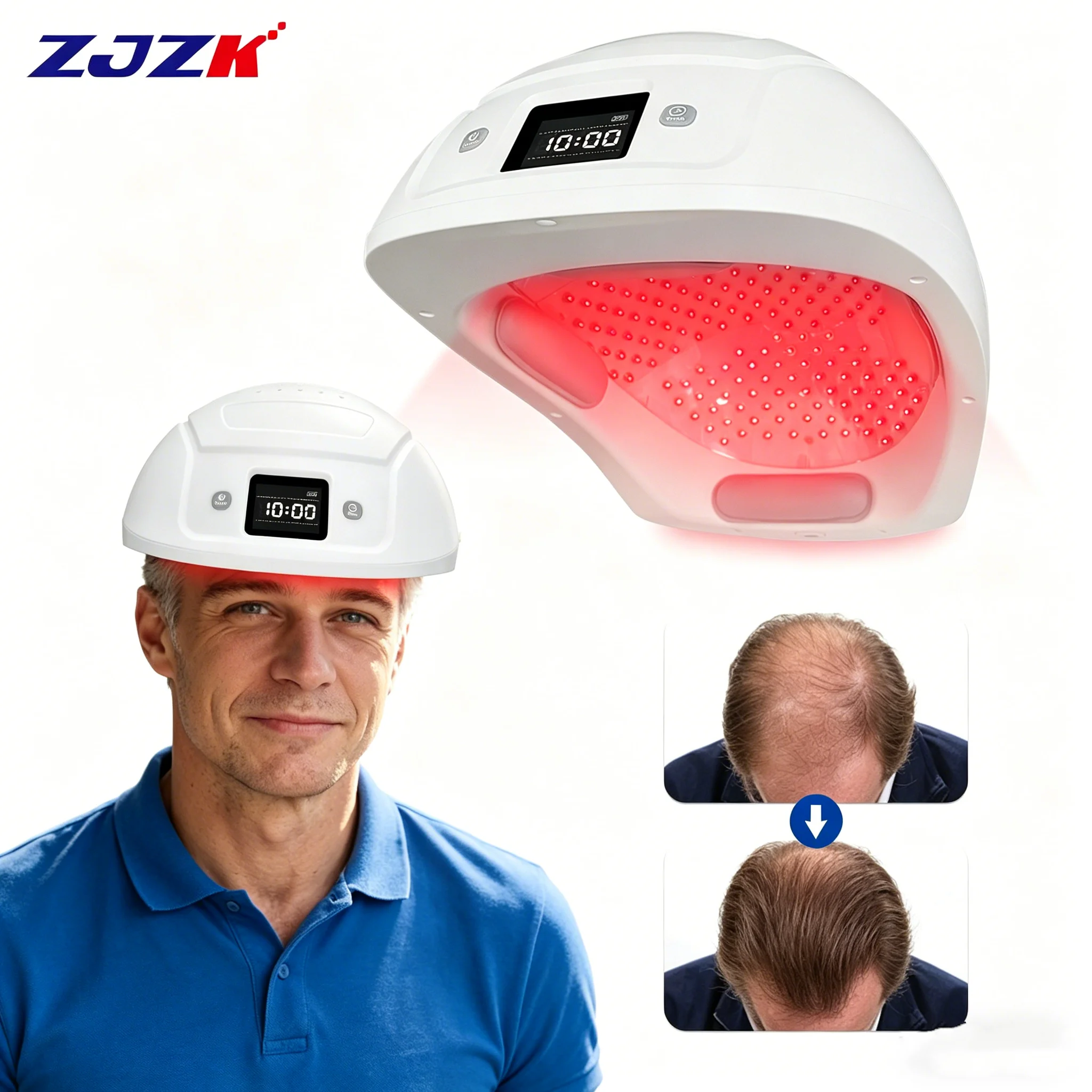 

2026 ZJZK Laser Hair Regrowth Helmet Device 650nm 448 PCS Laser Diodes for Hair Loss Therapy Hair Growth Treatment Cost