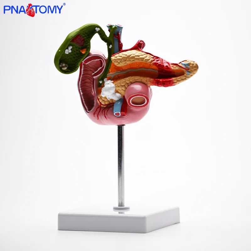 

Anatomical Model of Pathological Structure of Pancreas Duodenum and Gallbladder in Medical Human Body