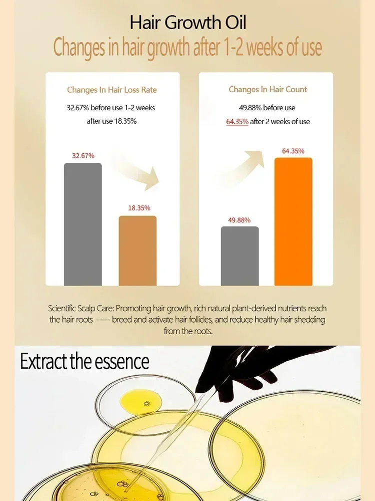 น้ำมันเซรั่มการเจริญเติบโตของเส้นผมที่มีประสิทธิภาพช่วยบำรุงรากผมงอกใหม่เอสเซนส์สำหรับผู้ชายผู้หญิง