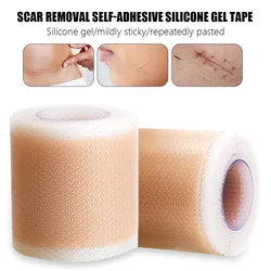 Fita adesiva auto-adesiva em gel de silicone, removedor de cicatriz eficiente 4*50/150cm, tratamento de reparação de pele para acne, queima de cicatriz