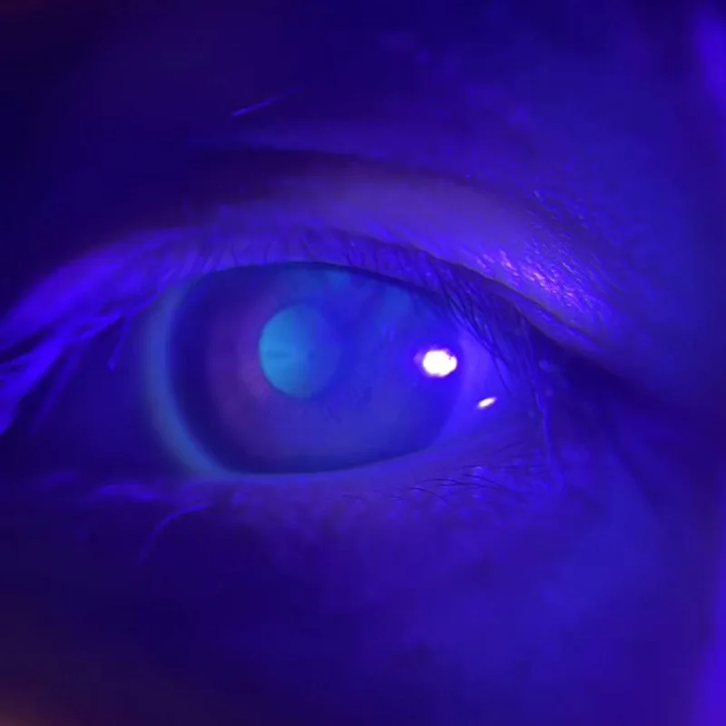 مدقق حالة القزحية البسيطة Optometria ، 1.00X-3.00X كاميرا تكبير محول الهاتف المحمول ، اخذ صور العيون ، إضاءة لمبة ليد