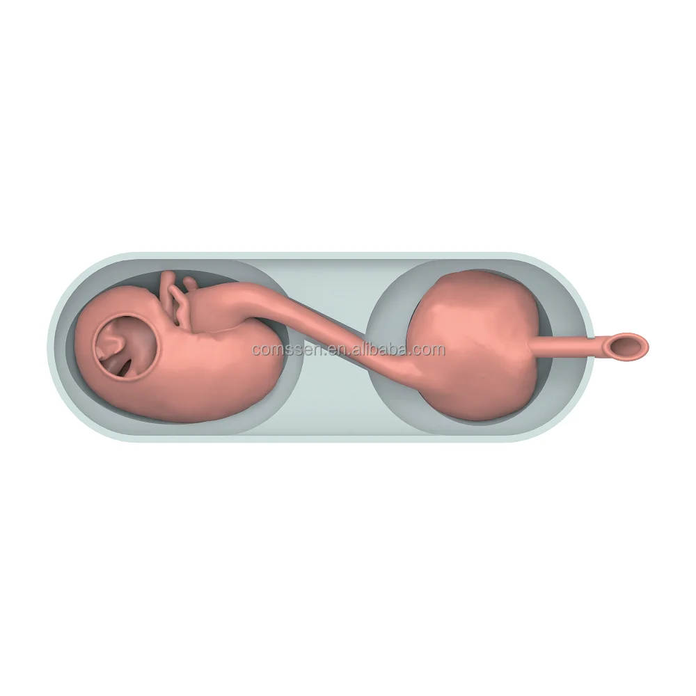 Simulation System of Cystoscope Operation