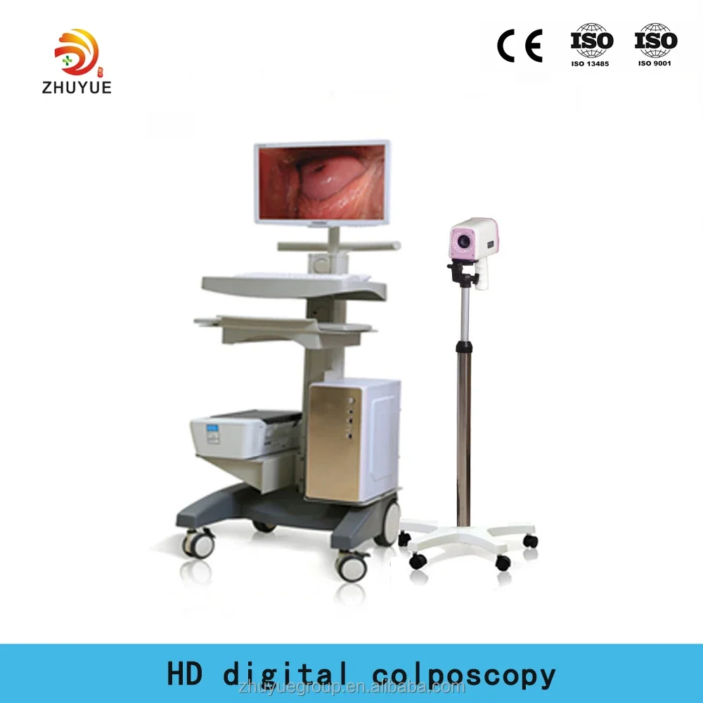 Video colpo scope Medical Digital Video colpo scope Visual colpo scope