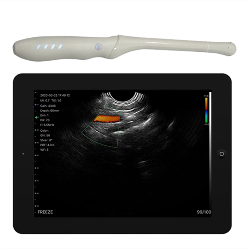 6Mhz/8Mhz USB Wifi Wireless Color Doppler Transvaginal Palm ultrasound Probe